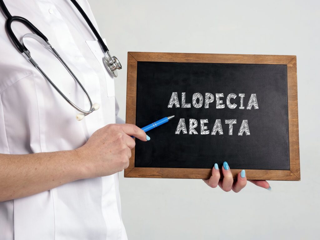 New genetic insights into alopecia areata